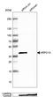 Actin Related Protein 2/3 Complex Subunit 1A antibody, HPA004334, Atlas Antibodies, Western Blot image 