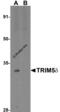 Tripartite motif-containing protein 5 antibody, 3241, ProSci, Western Blot image 