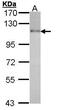 Hepatocyte Growth Factor-Regulated Tyrosine Kinase Substrate antibody, GTX101738, GeneTex, Western Blot image 
