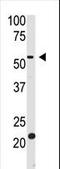 Beta-secretase 2 antibody, LS-C100369, Lifespan Biosciences, Western Blot image 