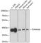 Translocase Of Outer Mitochondrial Membrane 40 antibody, 18-997, ProSci, Western Blot image 