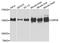 Ubiquitin Specific Peptidase 25 antibody, A7975, ABclonal Technology, Western Blot image 