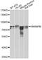 Heterogeneous Nuclear Ribonucleoprotein M antibody, STJ29017, St John