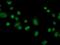FKBP Prolyl Isomerase Like antibody, MA5-25356, Invitrogen Antibodies, Immunocytochemistry image 