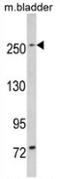 Leucine Rich Repeat Kinase 1 antibody, AP13690PU-N, Origene, Western Blot image 