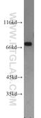 Activating Transcription Factor 2 antibody, 14834-1-AP, Proteintech Group, Western Blot image 