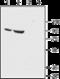 Sodium Channel Epithelial 1 Alpha Subunit antibody, GTX54809, GeneTex, Western Blot image 