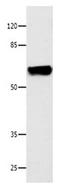 Cyclic Nucleotide Gated Channel Alpha 2 antibody, orb107374, Biorbyt, Western Blot image 