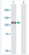 NEDD4 Binding Protein 1 antibody, H00009683-B01P-50ug, Novus Biologicals, Western Blot image 