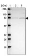 Tubulin Tyrosine Ligase Like 12 antibody, NBP2-33852, Novus Biologicals, Western Blot image 