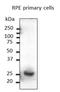 RAB31, Member RAS Oncogene Family antibody, orb334989, Biorbyt, Western Blot image 