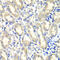 Prostaglandin E Synthase 2 antibody, 22-732, ProSci, Immunohistochemistry paraffin image 
