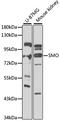 Smoothened, Frizzled Class Receptor antibody, A3274, ABclonal Technology, Western Blot image 