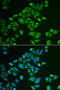 Transgelin antibody, STJ28843, St John