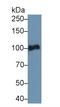 Plasminogen antibody, LS-C295935, Lifespan Biosciences, Western Blot image 