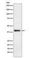 Alcohol Dehydrogenase 1A (Class I), Alpha Polypeptide antibody, M06473-1, Boster Biological Technology, Western Blot image 