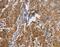Programmed Cell Death 1 Ligand 2 antibody, MBS2527385, MyBioSource, Immunohistochemistry paraffin image 
