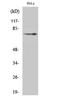 Nerve Growth Factor Receptor antibody, STJ94480, St John