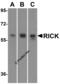 Receptor Interacting Serine/Threonine Kinase 2 antibody, 2075, ProSci, Western Blot image 