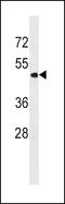 Patatin Like Phospholipase Domain Containing 3 antibody, LS-C163825, Lifespan Biosciences, Western Blot image 