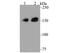 Cytoplasmic Linker Associated Protein 1 antibody, NBP2-76881, Novus Biologicals, Western Blot image 