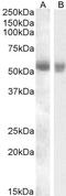 Transmembrane protease serine 2 antibody, GTX88625, GeneTex, Western Blot image 