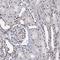 Methyltransferase Like 14 antibody, NBP1-81392, Novus Biologicals, Immunohistochemistry paraffin image 