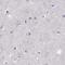 Interphotoreceptor Matrix Proteoglycan 1 antibody, PA5-65006, Invitrogen Antibodies, Immunohistochemistry paraffin image 