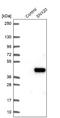 Sorting Nexin 20 antibody, NBP1-92418, Novus Biologicals, Western Blot image 