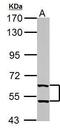 Thioredoxin Reductase 1 antibody, GTX108727, GeneTex, Western Blot image 