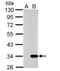 Galectin 9 antibody, NBP2-16587, Novus Biologicals, Western Blot image 