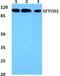 Elongation Factor Tu GTP Binding Domain Containing 2 antibody, GTX66744, GeneTex, Western Blot image 