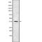 Casein Kinase 1 Alpha 1 antibody, abx149352, Abbexa, Western Blot image 