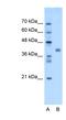 Transmembrane Protein 59 Like antibody, NBP1-62564, Novus Biologicals, Western Blot image 