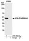 Enterokinase Cleavage Site tag antibody, A191-100, Bethyl Labs, Immunoprecipitation image 