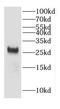 Coiled-Coil-Helix-Coiled-Coil-Helix Domain Containing 6 antibody, FNab01638, FineTest, Western Blot image 