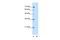 GDP-Mannose Pyrophosphorylase B antibody, A08665, Boster Biological Technology, Western Blot image 