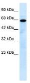 Mucolipin 1 antibody, ab28508, Abcam, Western Blot image 