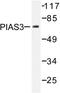 Protein Inhibitor Of Activated STAT 3 antibody, LS-C176343, Lifespan Biosciences, Western Blot image 