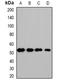 HCLS1 Binding Protein 3 antibody, orb341459, Biorbyt, Western Blot image 