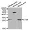 Cystatin 8 antibody, A1224, ABclonal Technology, Western Blot image 