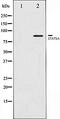 Signal Transducer And Activator Of Transcription 5A antibody, orb106438, Biorbyt, Western Blot image 