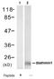 Stathmin 1 antibody, AP08091PU-N, Origene, Western Blot image 