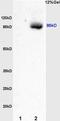 Smoothened, Frizzled Class Receptor antibody, GTX60154, GeneTex, Western Blot image 