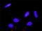 Mitogen-Activated Protein Kinase Kinase Kinase 11 antibody, H00004296-M02, Novus Biologicals, Proximity Ligation Assay image 