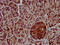 CLPTM1 Like antibody, CSB-PA850323LA01HU, Cusabio, Immunohistochemistry frozen image 