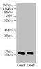 Fatty Acid Binding Protein 1 antibody, CSB-PA007940YA01HU, Cusabio, Western Blot image 