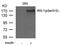Insulin Receptor Substrate 1 antibody, GTX50680, GeneTex, Western Blot image 