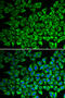 Interleukin 12 Receptor Subunit Beta 1 antibody, 18-365, ProSci, Immunofluorescence image 
