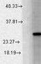 Potassium Calcium-Activated Channel Subfamily M Regulatory Beta Subunit 2 antibody, GTX42010, GeneTex, Western Blot image 